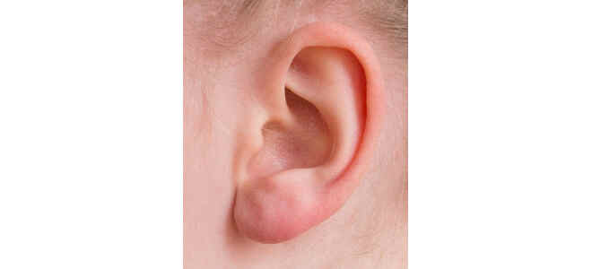 ear