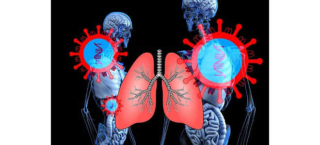  bronchial 